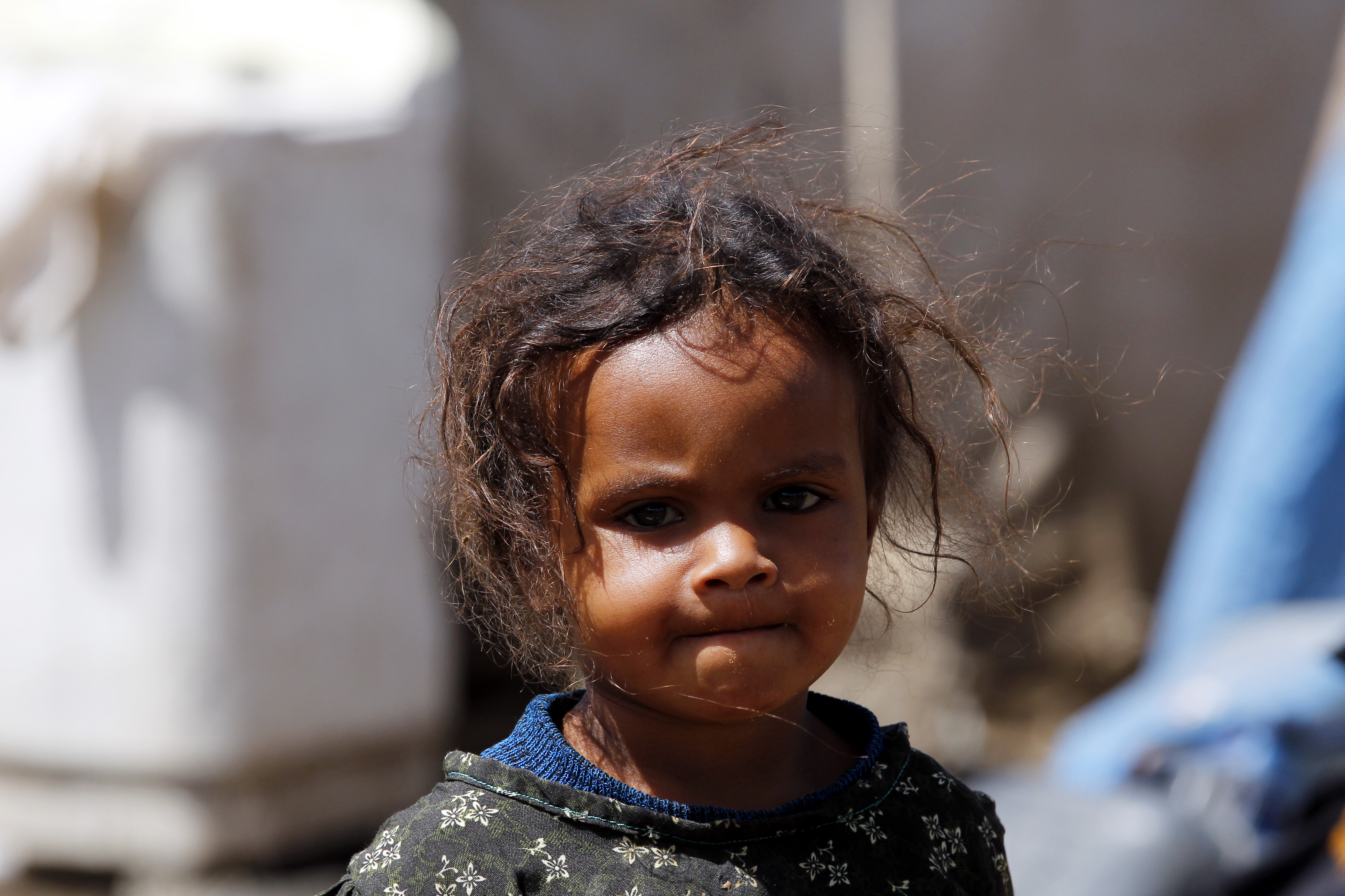 Yemen puede ser la peor hambruna en 100 años.