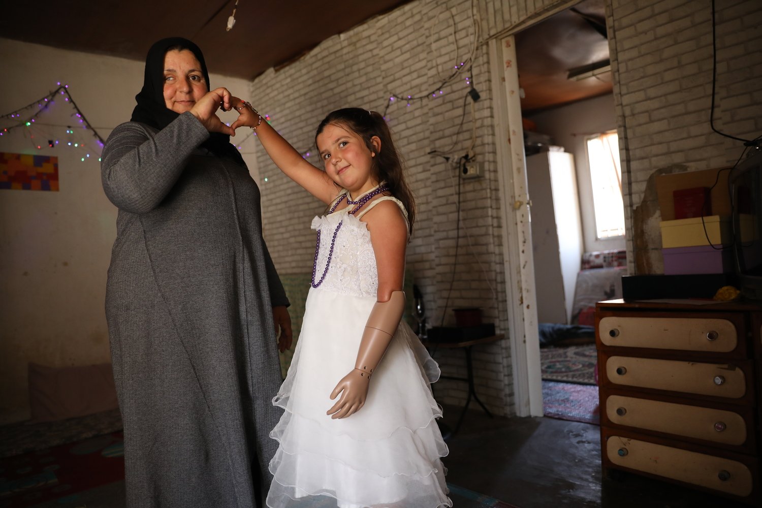 Una niña con prótesis de brazo posa con un vestido blanco, tomada de la mano de su madre. Una niña con prótesis de brazo posa con un vestido blanco, tomada de la mano de su madre.