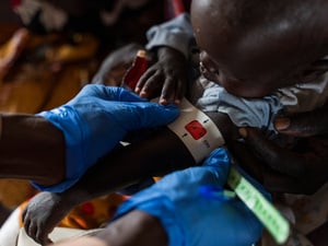 Un niño es evaluado por desnutrición en un centro de salud del campamento de Um Sagour, en Sudán.